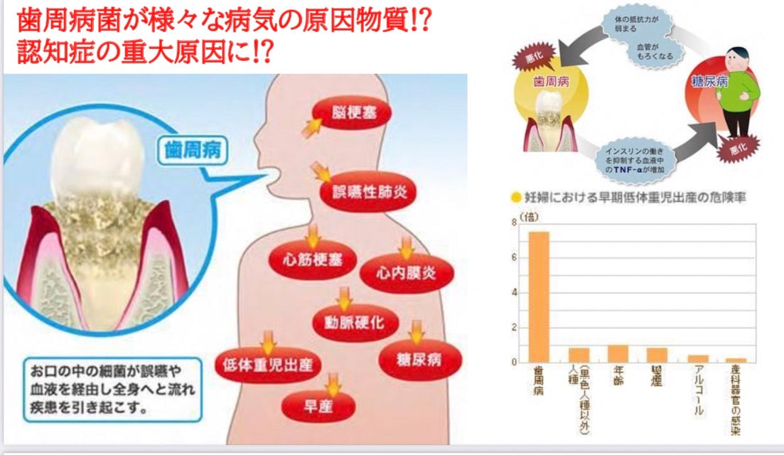 口腔ケア(ホームケア)